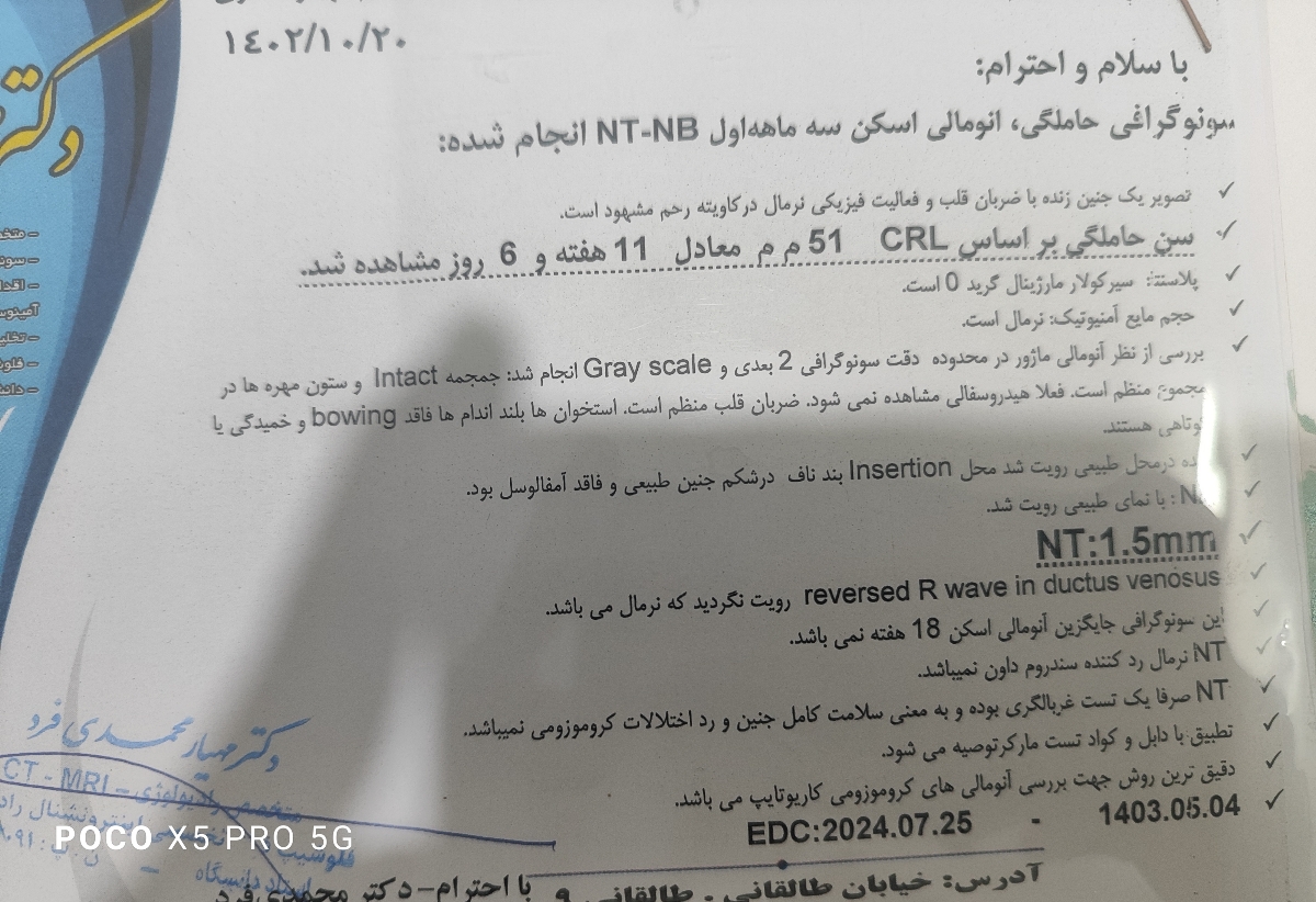 این ان تی 