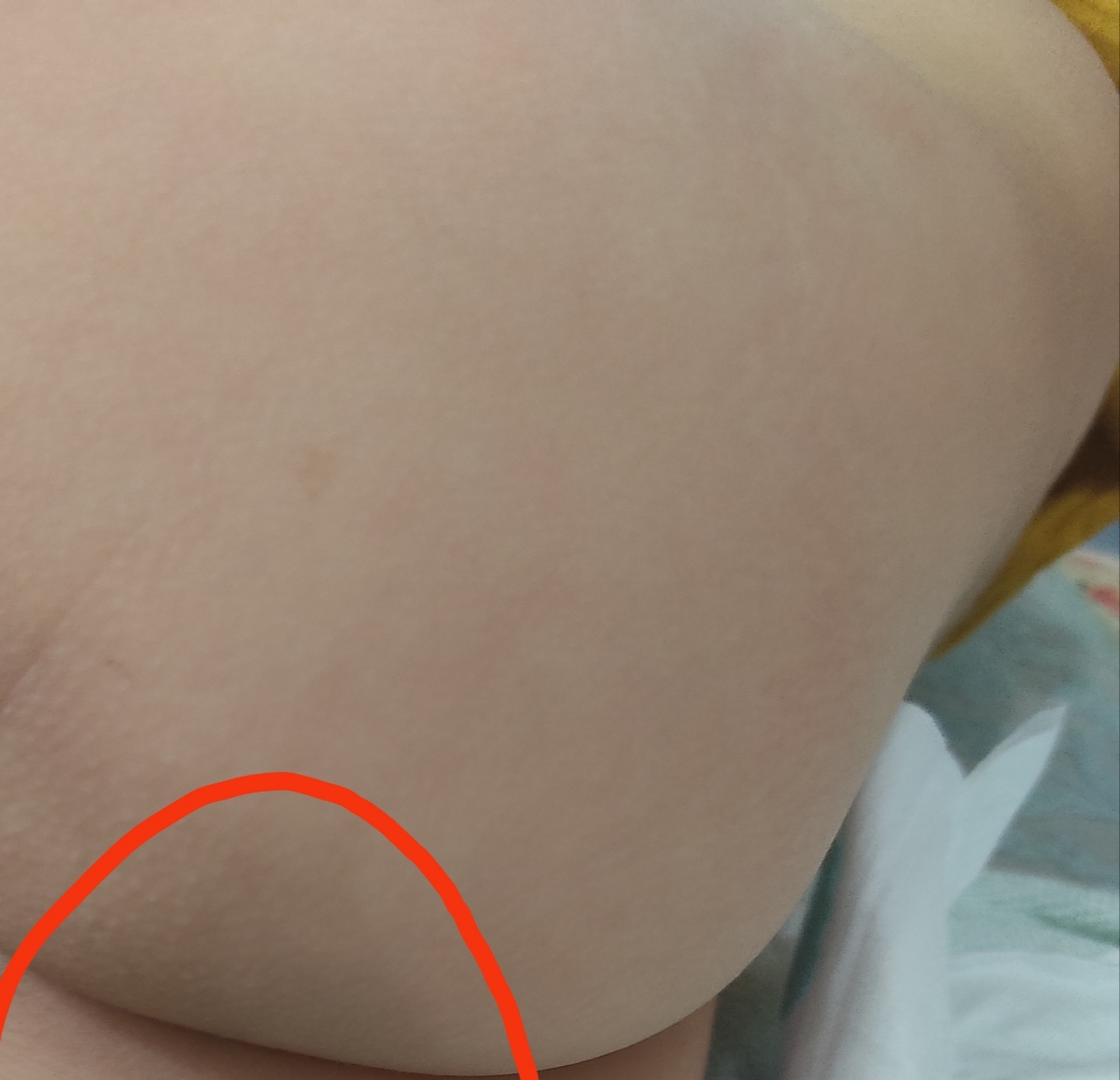 کنار مقعدش ی هاله سیاه افتاده 