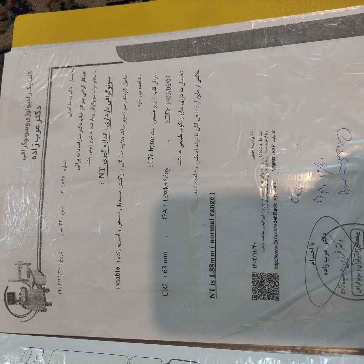 سونوگرافی آخر بارداری