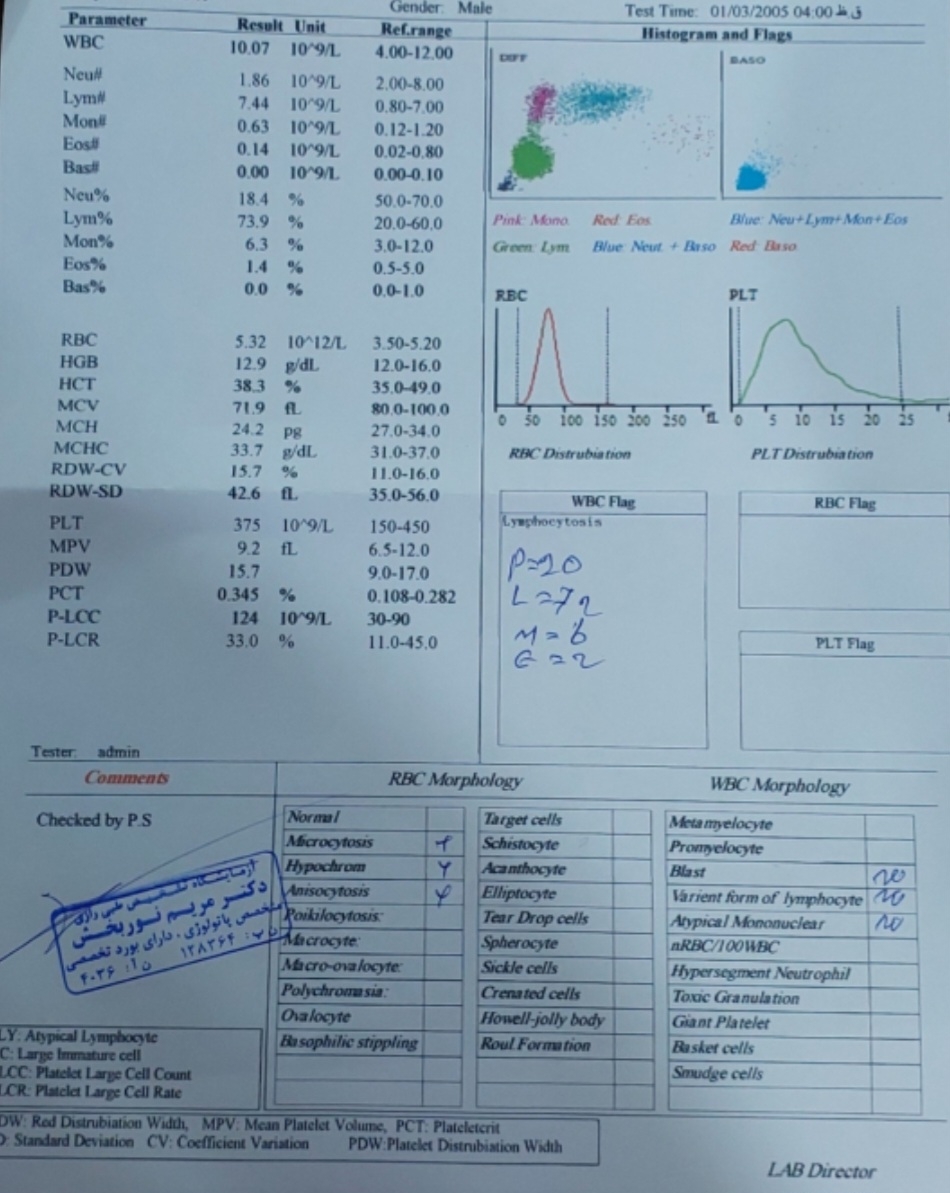 تفسیر آزمایش خون کودک یکساله