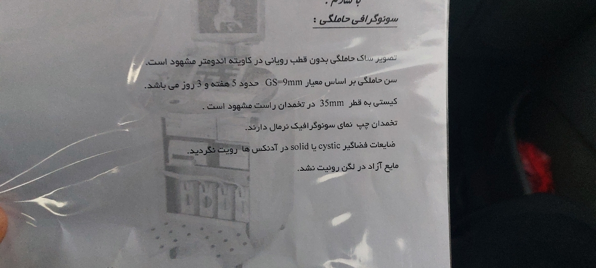 کیست تخمدان و بارداری دکتر عزیزم خیلی نگرانم کیست تخمدان و بارداری دکتر عزیزم خیلی نگرانم