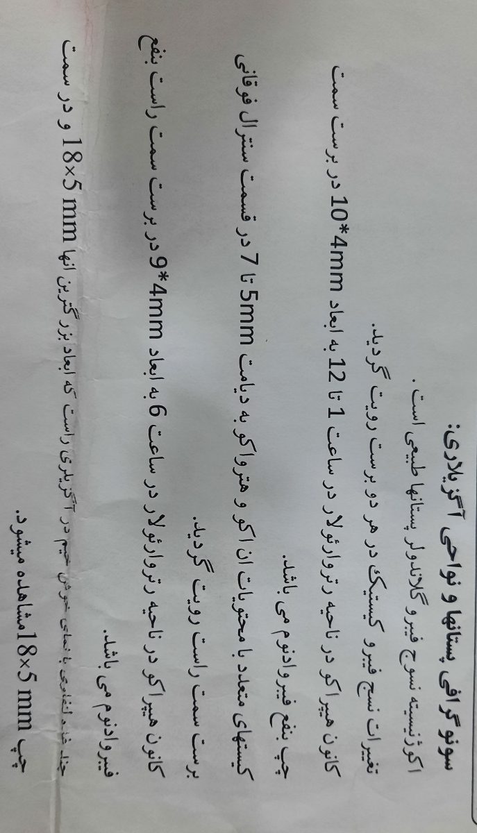 قط نشدن خونریزی بعد از سقط