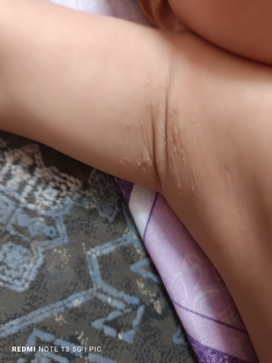 پوست بچم حالت دون دون ریخته‌ بیرون