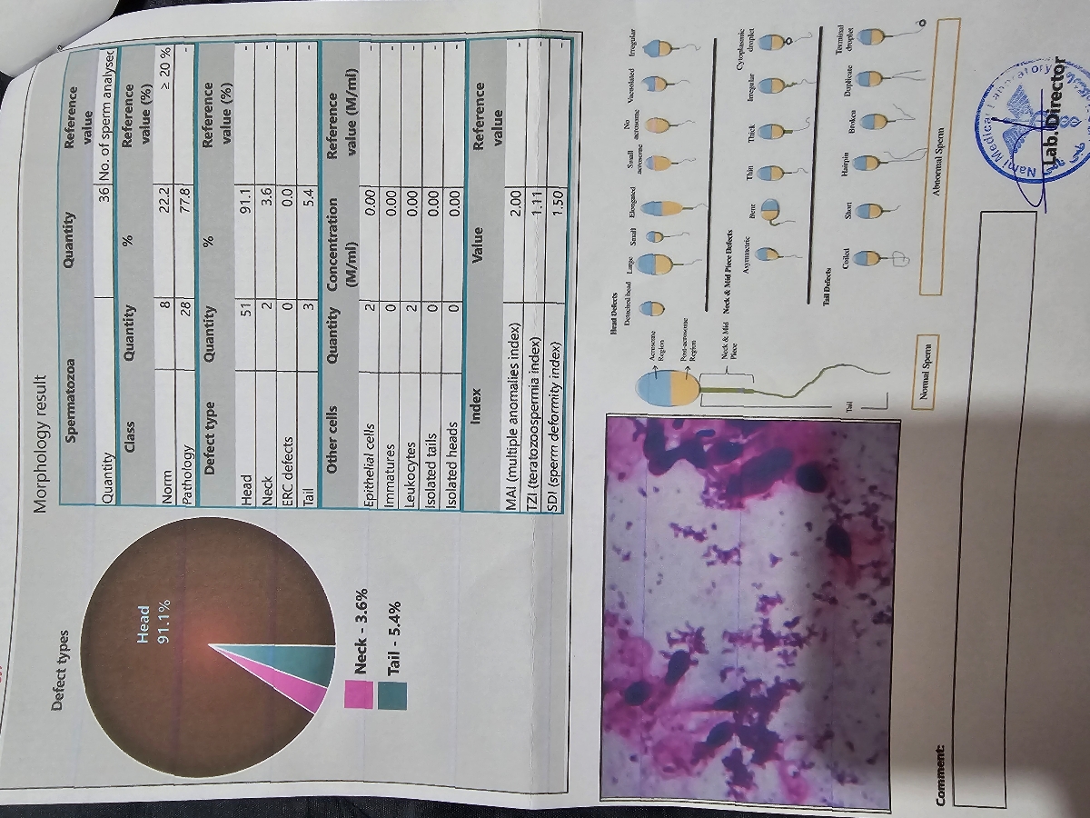 تفسیر ازمایش اسپرم