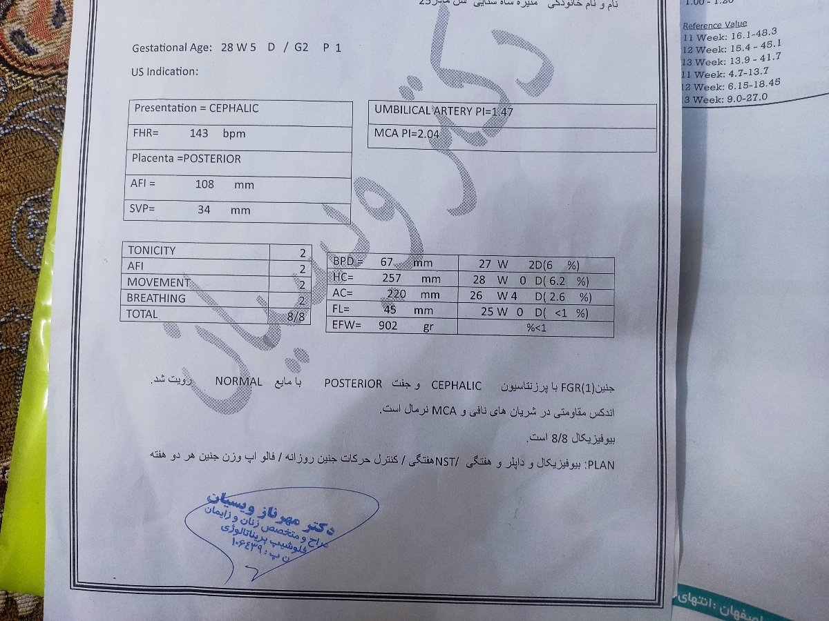 رشد جنین بیست و نه هفته