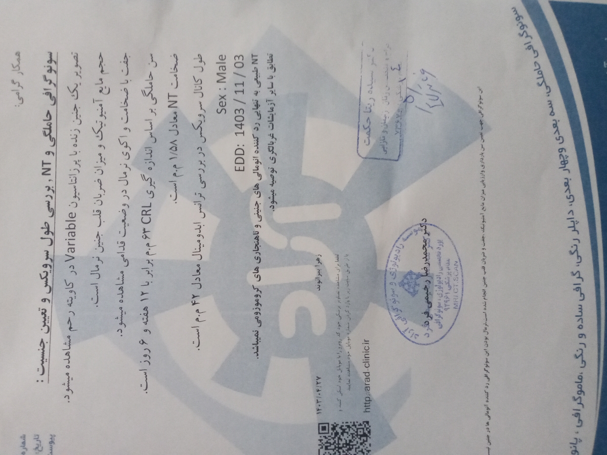 ازمایش غربالگری دوم و چه ازمایشی ازمایش غربالگری دوم و چه ازمایشی
