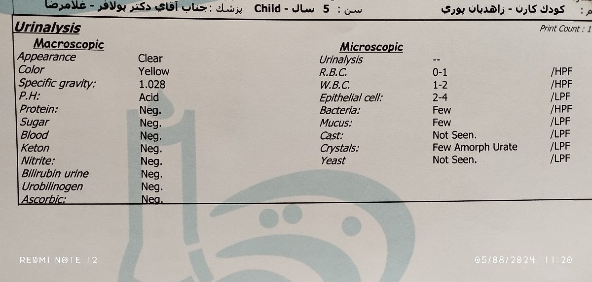 تفصیر آزمایش پسر ۵ساله