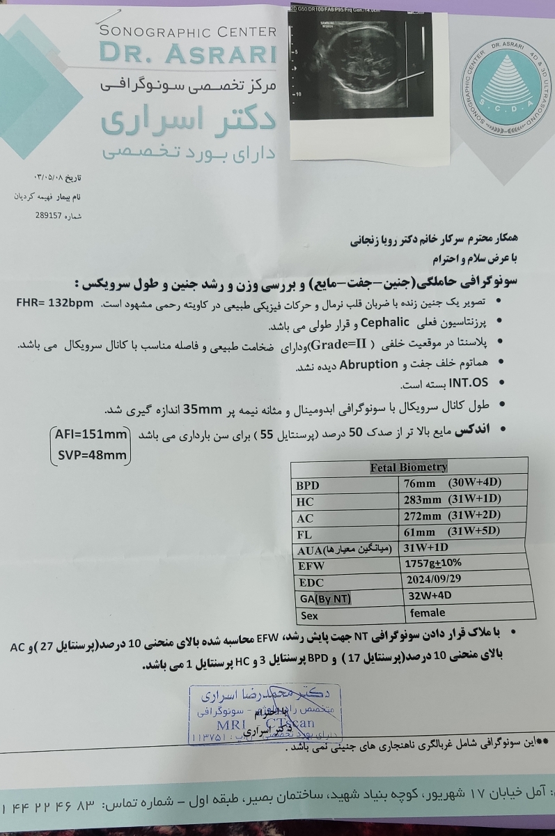 این سونوی قبلیمه