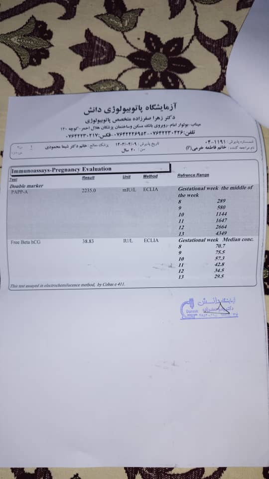 سلام تفسیرسونو آنومالی