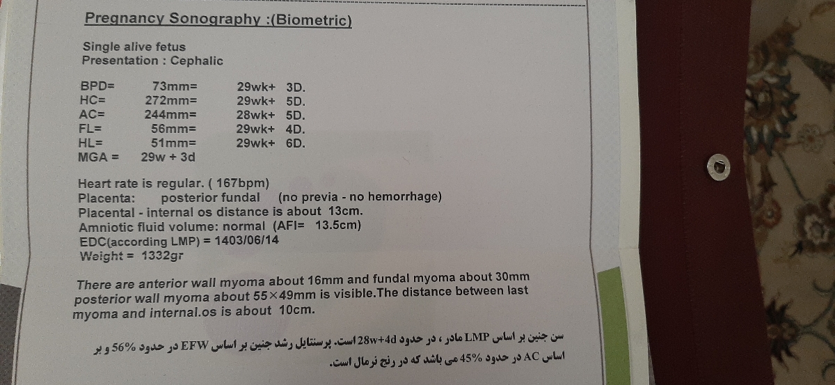 سونوی دومی