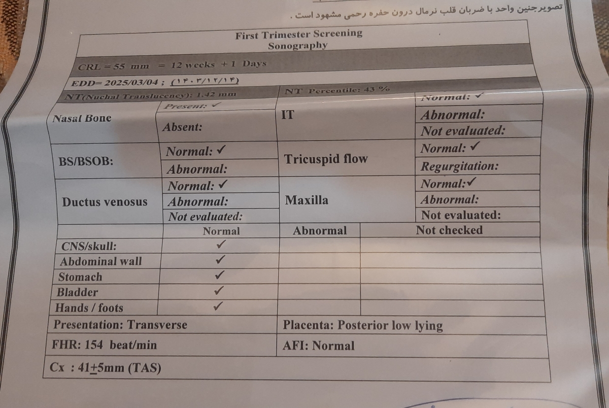 این سونو ان تی روز چهارشنبه 