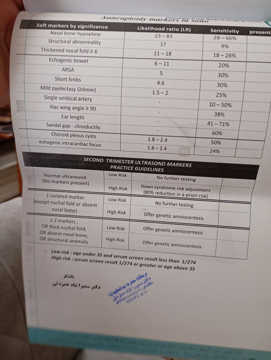 کیست مغز کوروئید درآنومالی