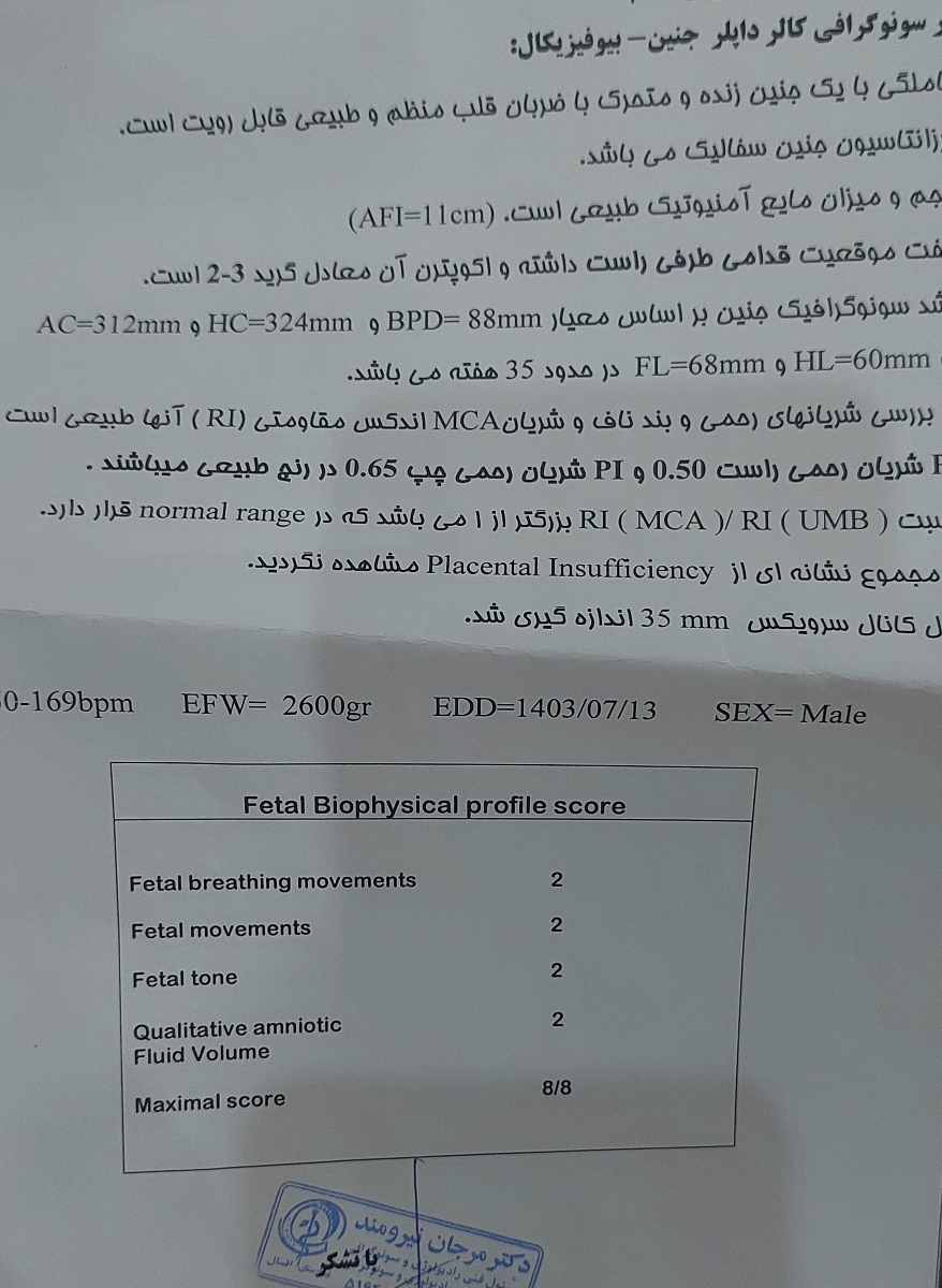 دلپیچه بارداری یا درد زایمان