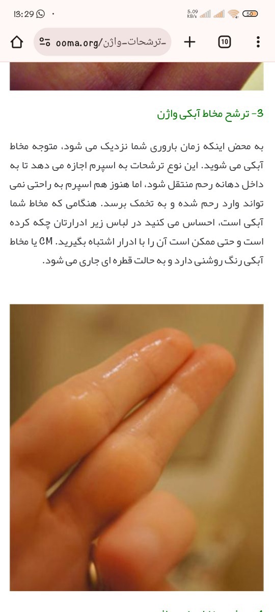 همیشه ترشحاتم اینطوریه. آبکی آبکی وسطش یکمی مایع سفید رقیق میبینم.