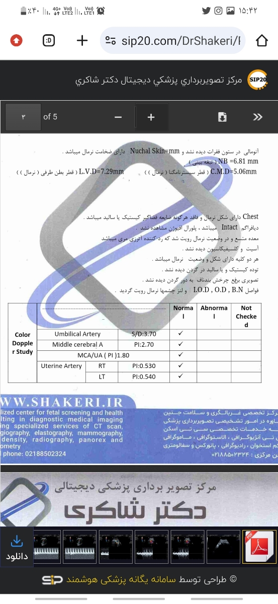 تفسیر سنو کالرداپلر و بیوفیزیکال و Nst