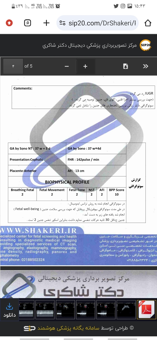 تفسیر سنو کالرداپلر و بیوفیزیکال و Nst