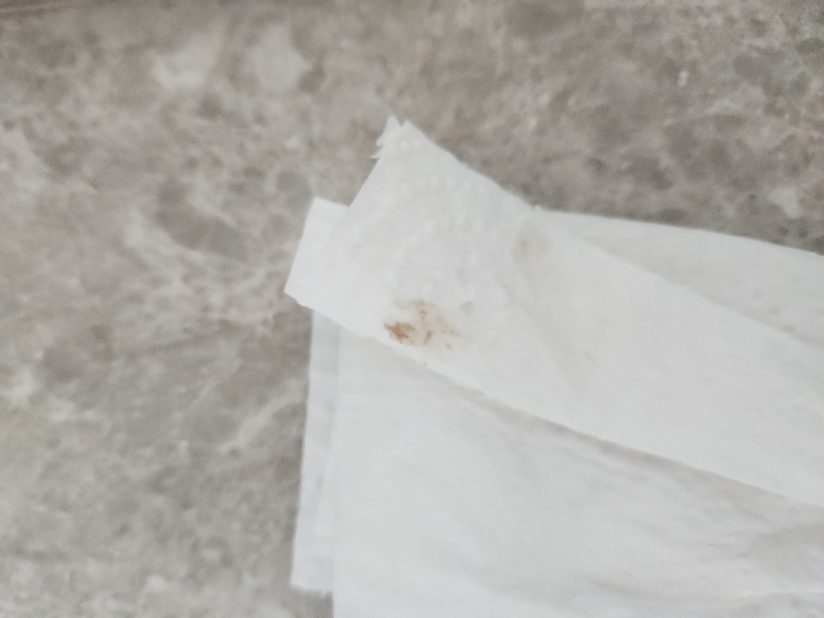 خیلی خیلی معذرت میخوام بابت ارسال این عکس. ترشحات الان در این حده