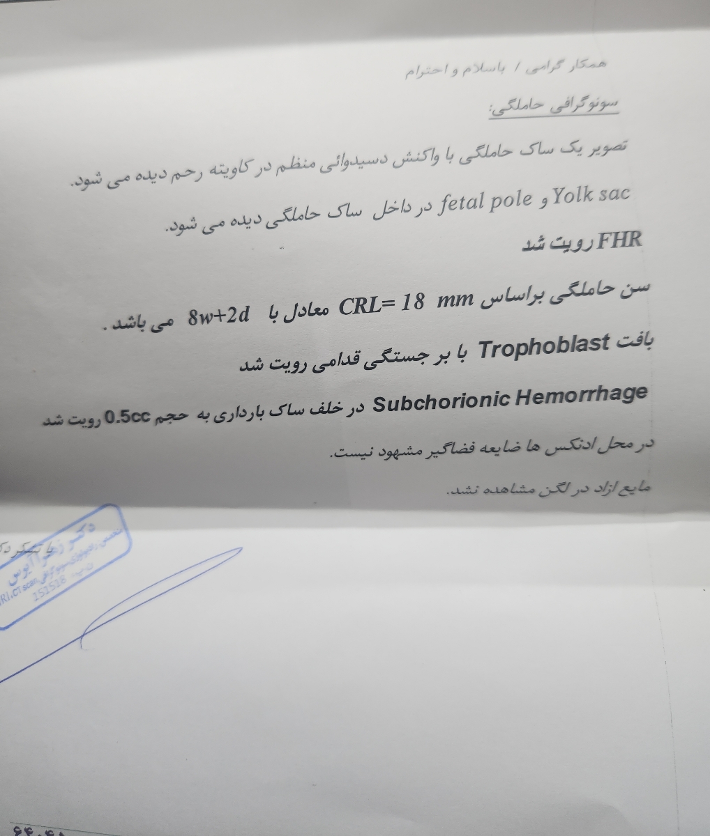 خونریزی و لکه بینی در بارداری