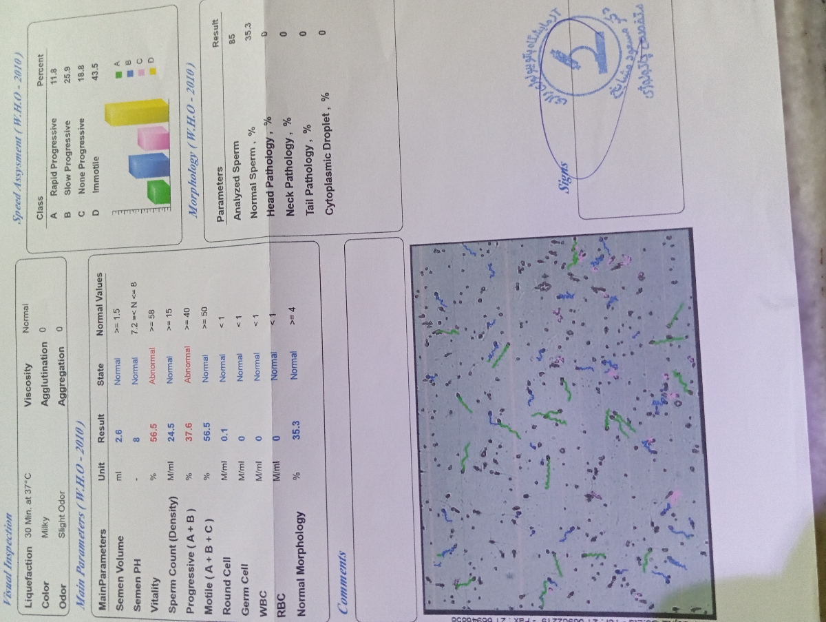 تفسیر آزمایش اسپرم شوهرم