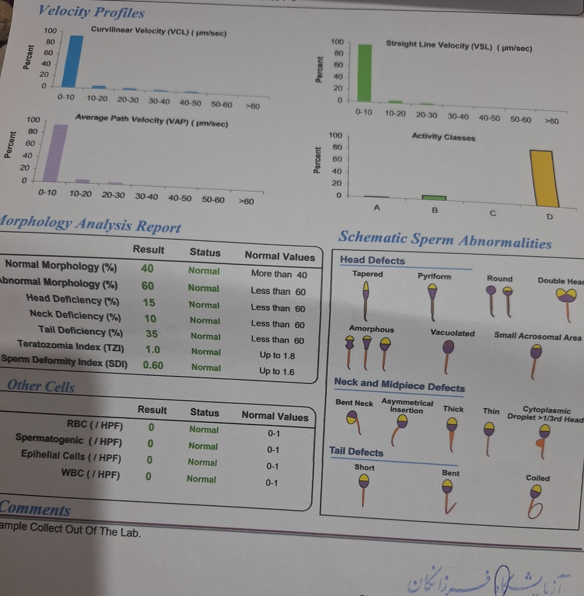 ممنون میشم آزمایش اسپرم روتفسیر کنید