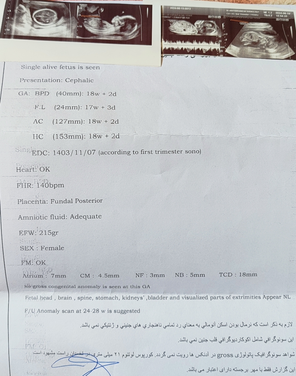 جواب غربالگری دوم بارداری
