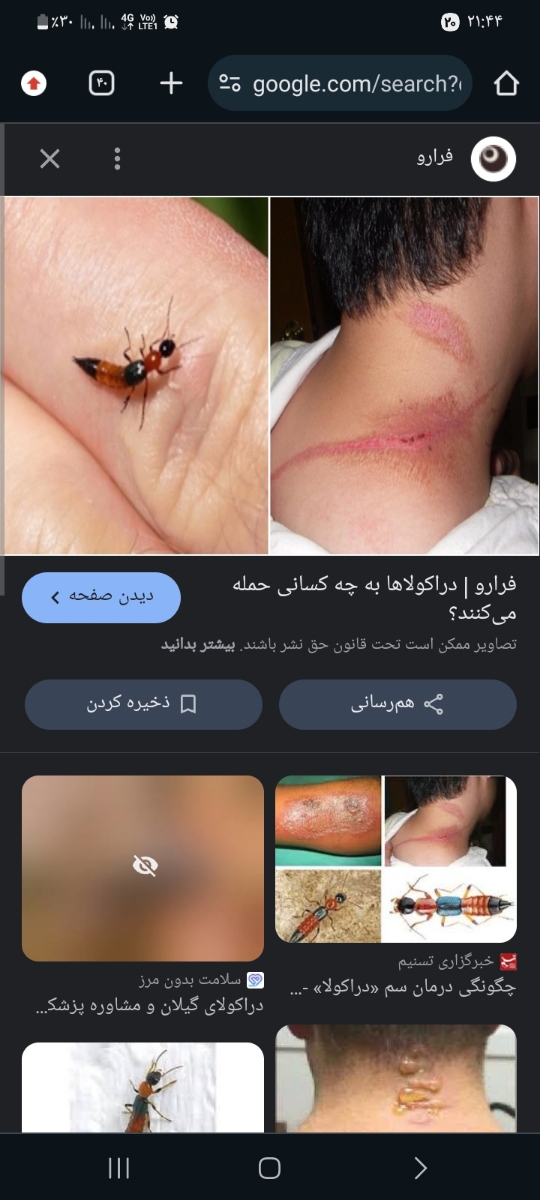 تشخیص نوع زایده پوستی