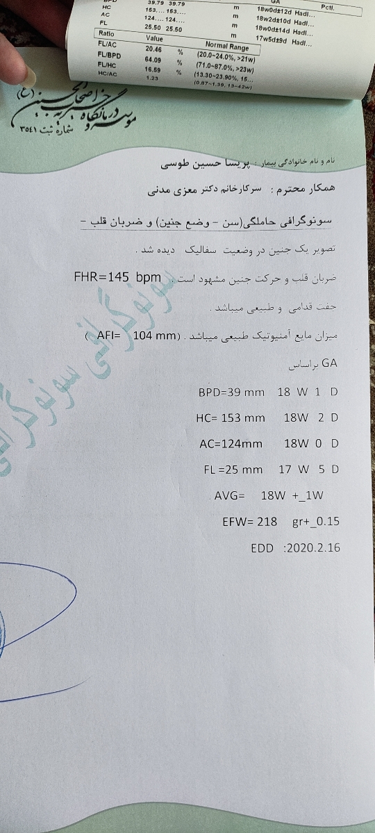 طول سیروکس در انومالی