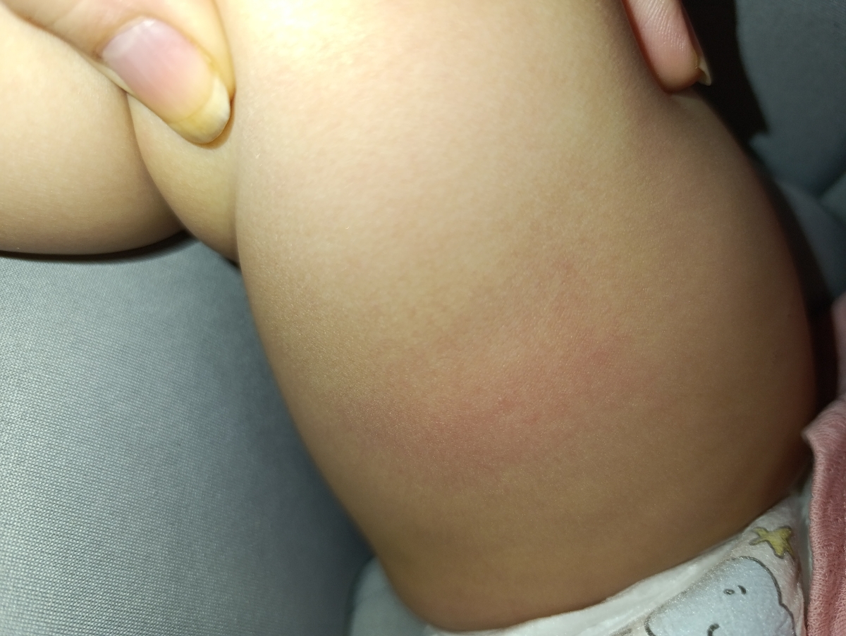 راه رفتن کودک و فرم پا راه رفتن کودک و فرم پا