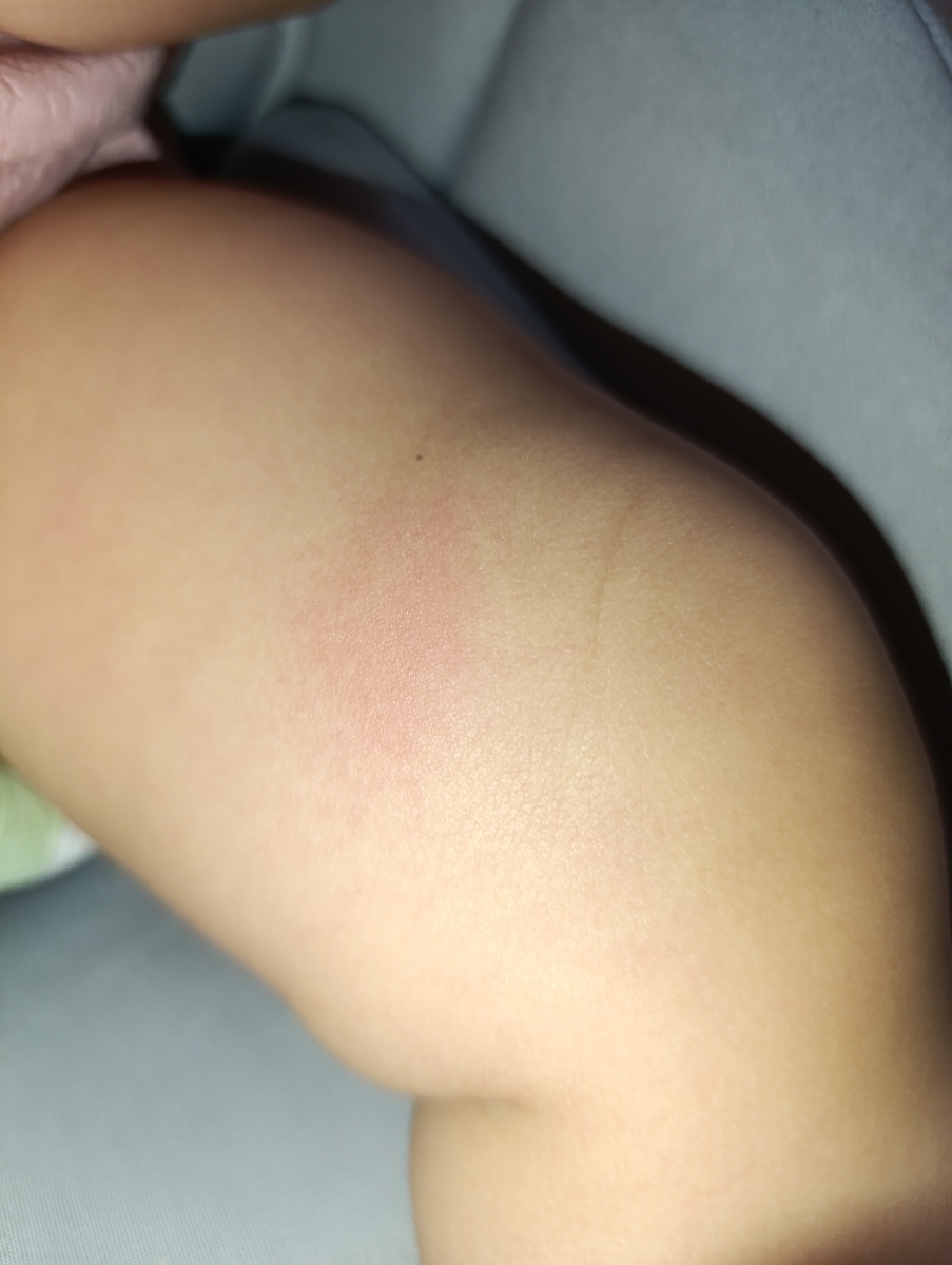 راه رفتن کودک و فرم پا راه رفتن کودک و فرم پا