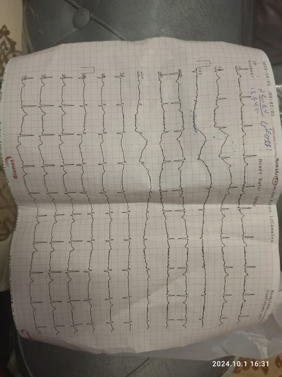 کسی بلده نتیجه نوار قلبو بگه