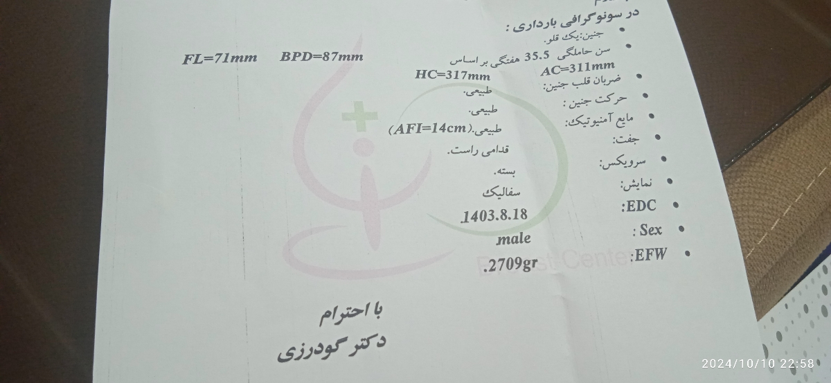 سونو سونو