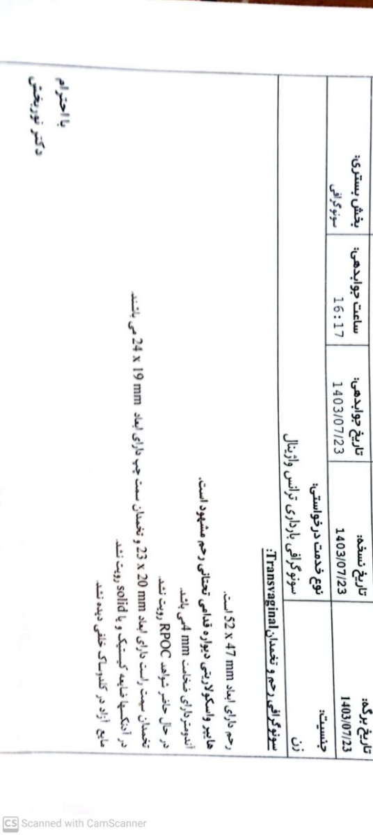 سونوگرافی بقایا سقط جنین