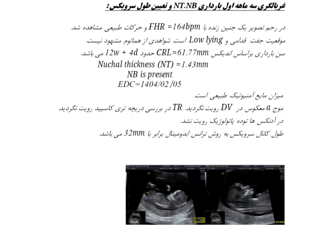 خانومای متخصص بیاین تعیین جنسیت