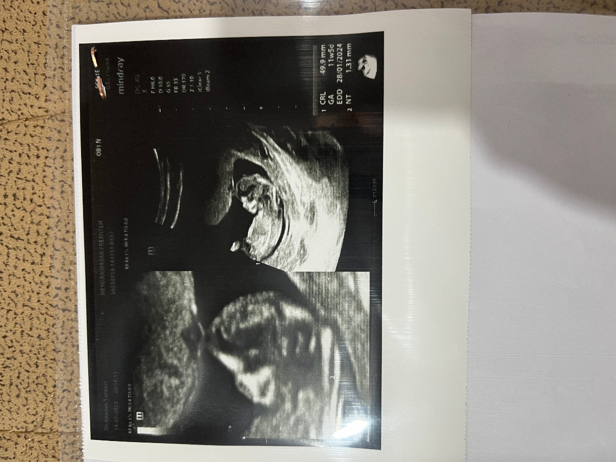 کسی هست بتونه از رو ان تی جنسیت و بگه