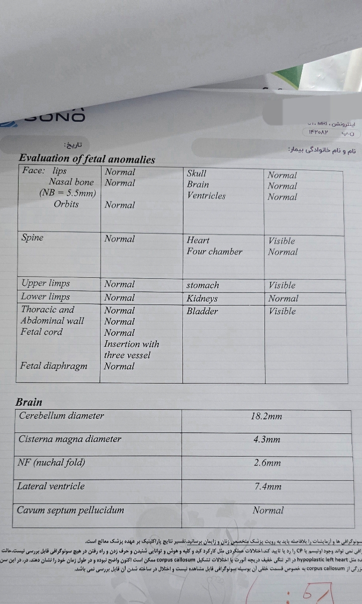 سونو در ۱۸ هفته و ۴ روز هماتوم۷۵ درصد