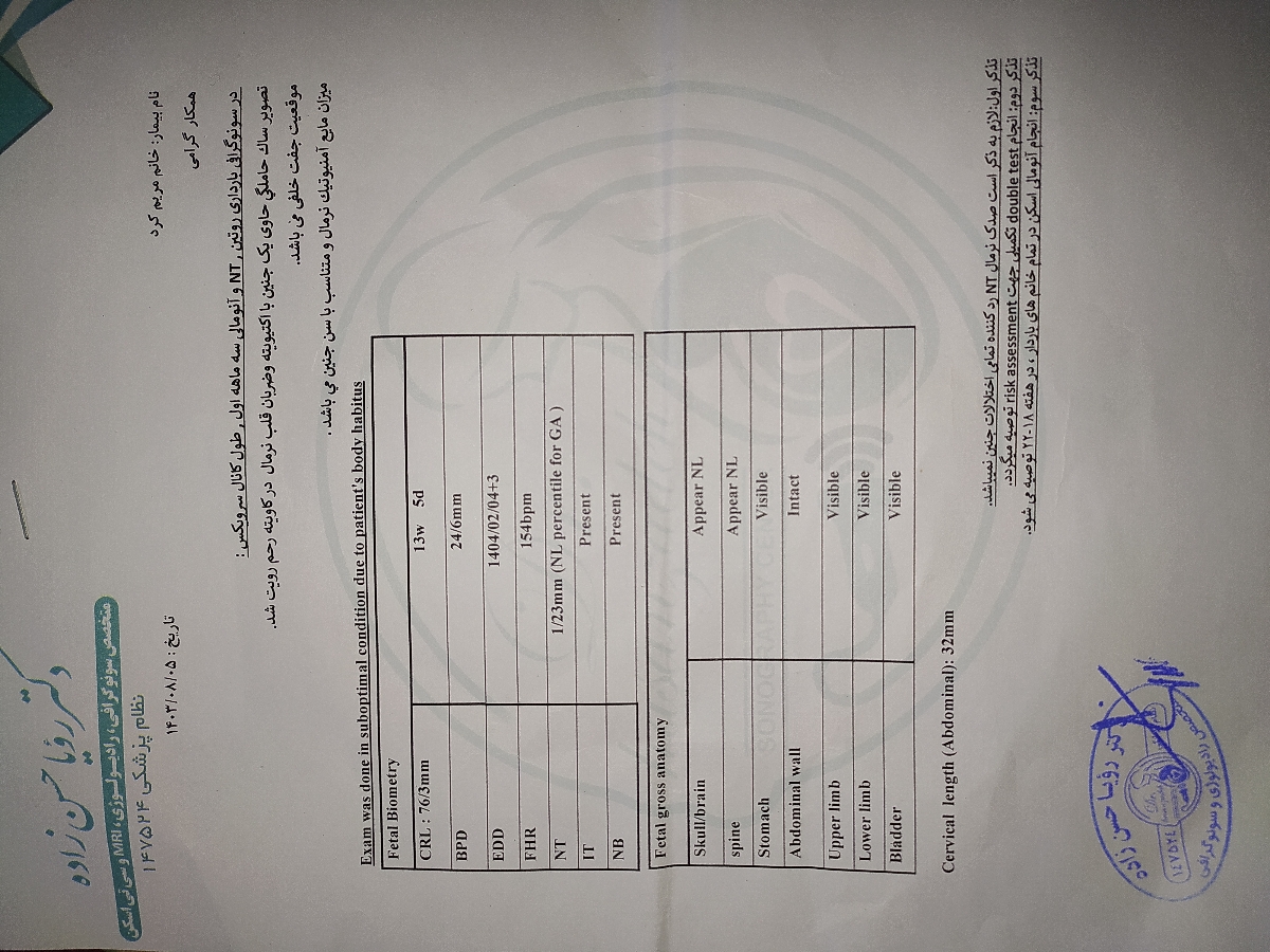 تشریح سونو ان تی