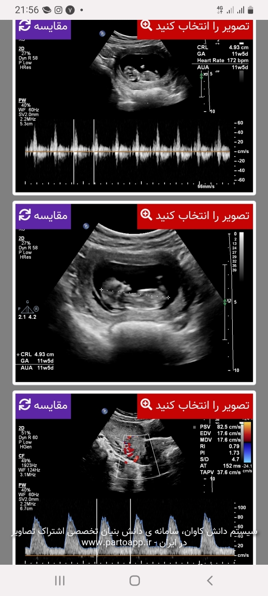 حدس جنسیت از روی عکس ان تی🚫