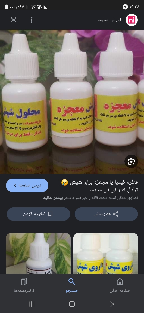 شپش سر کودک دوساله