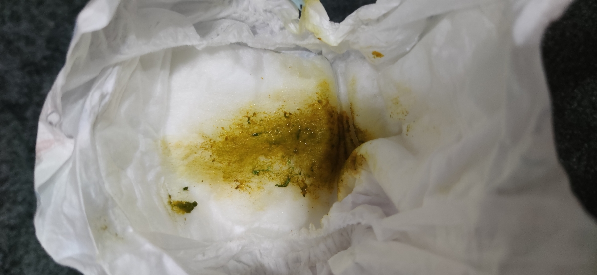 خانم دکتر ببخشید میشه این عکس رو ببینید