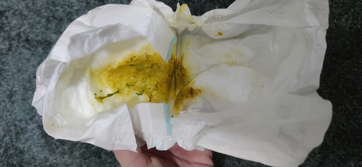 خانم دکتر ببخشید میشه این عکس رو ببینید