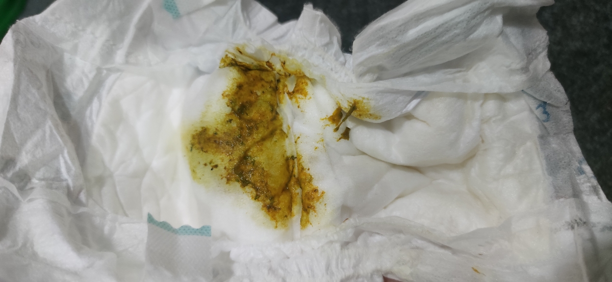 خانم دکتر ببخشید میشه این عکس رو ببینید