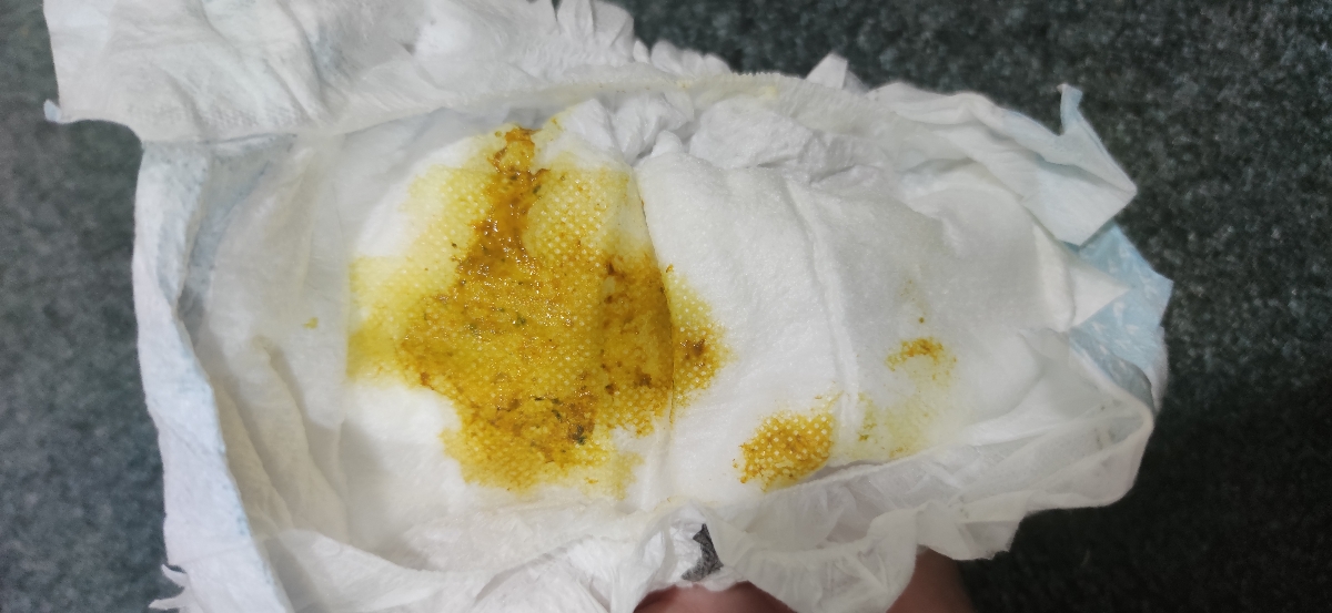 خانم دکتر ببخشید میشه این عکس رو ببینید