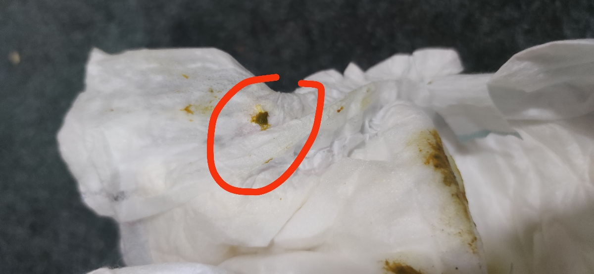 خانم دکتر ببخشید میشه این عکس رو ببینید