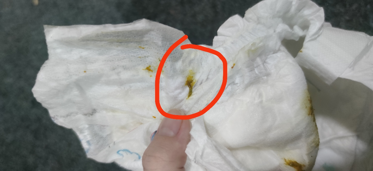 خانم دکتر ببخشید میشه این عکس رو ببینید