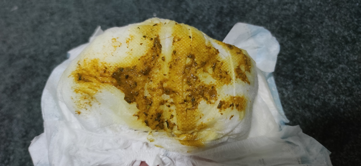 خانم دکتر ببخشید میشه این عکس رو ببینید