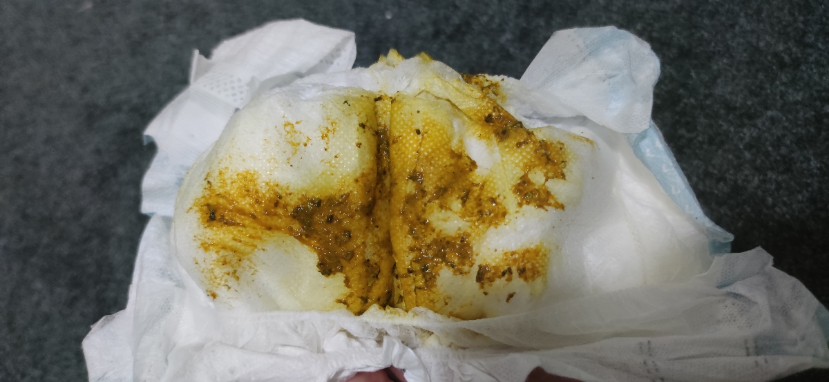 خانم دکتر ببخشید میشه این عکس رو ببینید