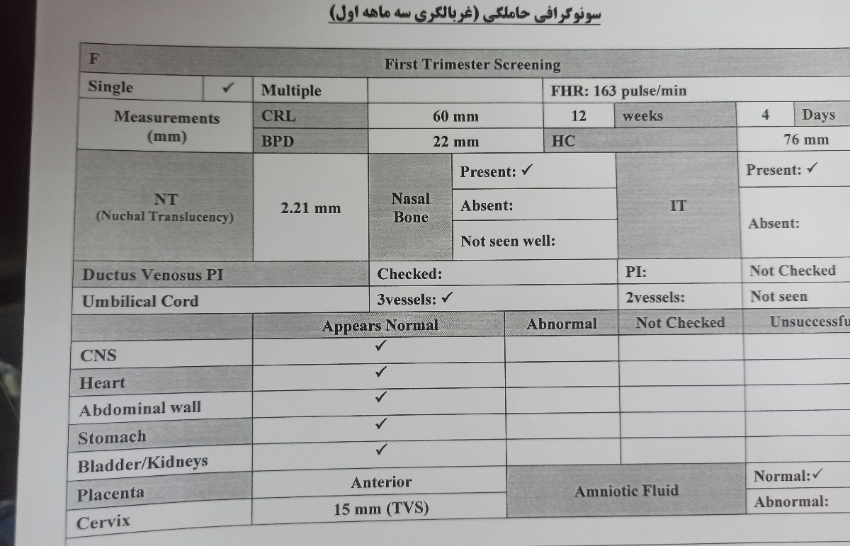 تفسیر سونو ان تی؟