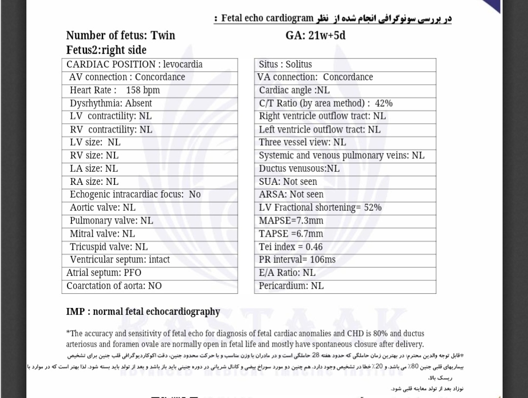 اکو قلب جنین دوقلویی