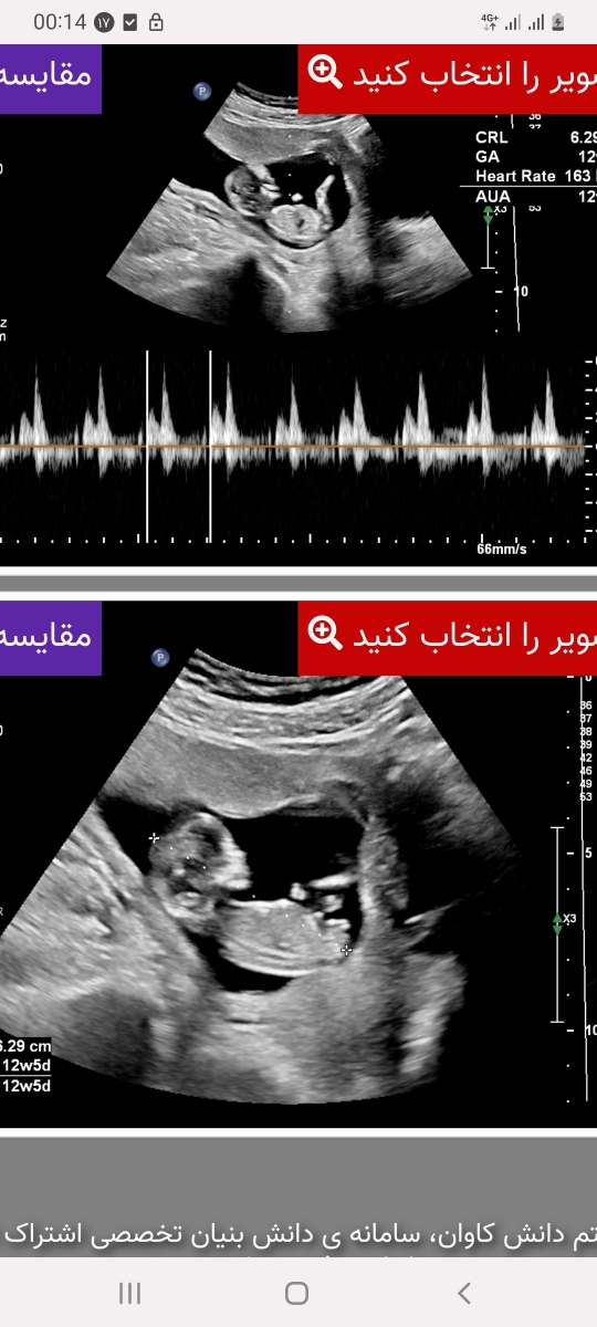 متخصص ها بیان ببینم این نی نی من چیه؟؟ من یکم عجولم🤭