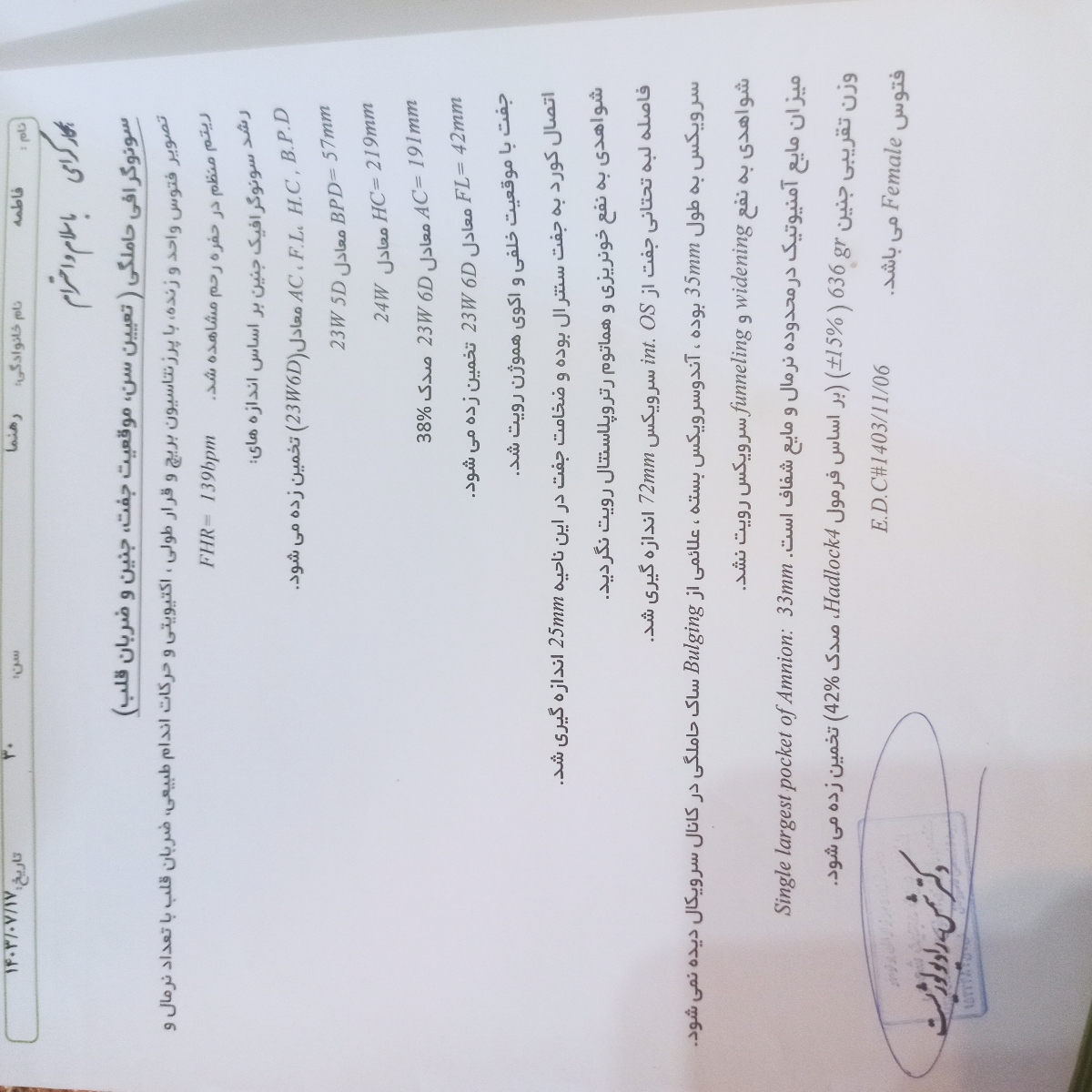 تکان خوردن زیاد جنین تکان خوردن زیاد جنین
